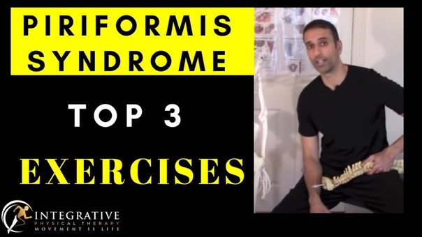How to treat leg pain and piriformis syndrome with trigger point work, nerve glides, and