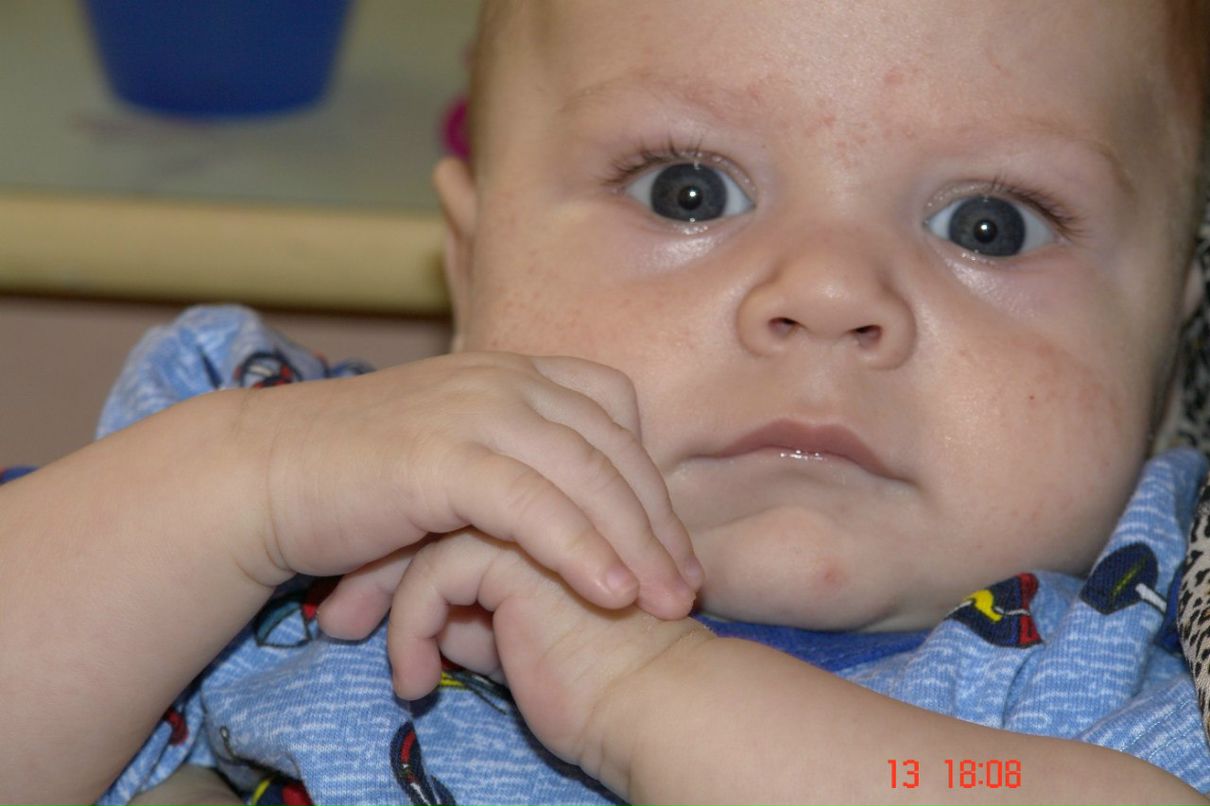 Альбина Суркова | Волгоград