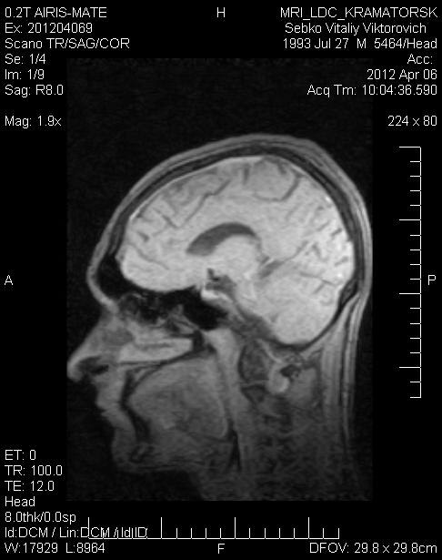 Витаха Себко | Краматорск