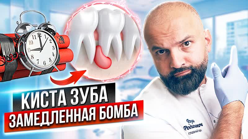 Киста зуба как лечить Как понять что у вас киста зуба Киста