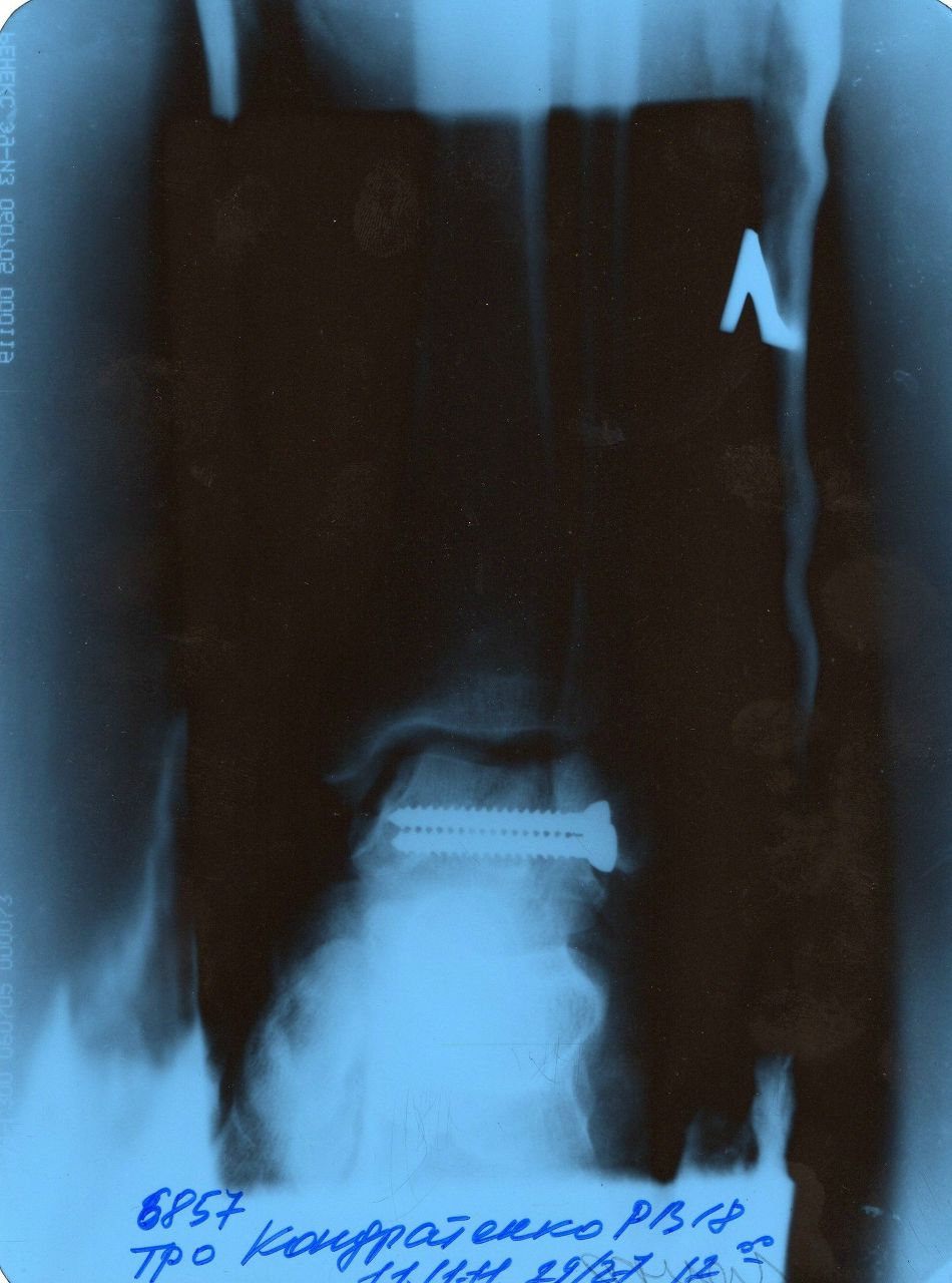 Руслан Кондратенко | Новокузнецк