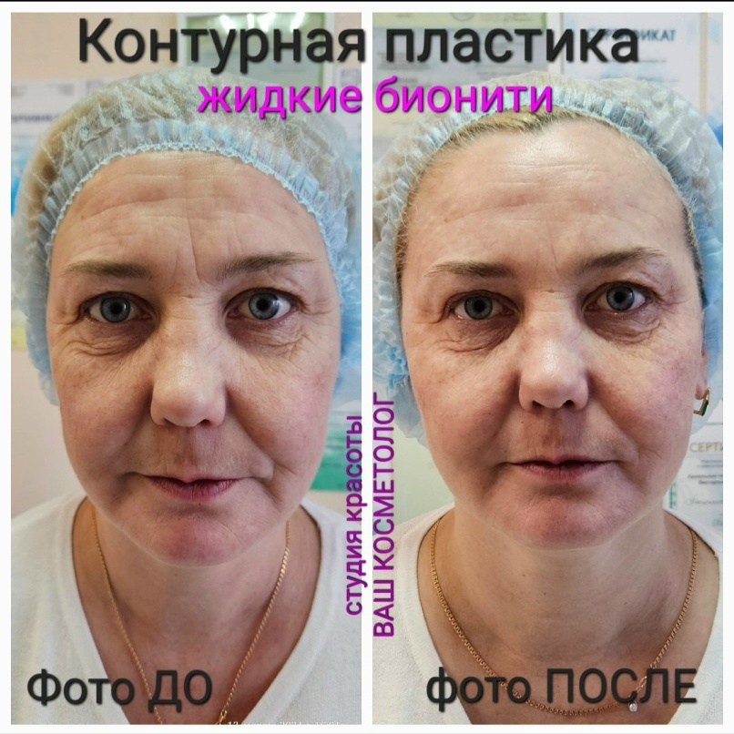 Жидкие нити до и после