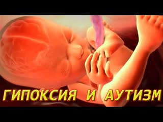 Гипоксия и аутизм